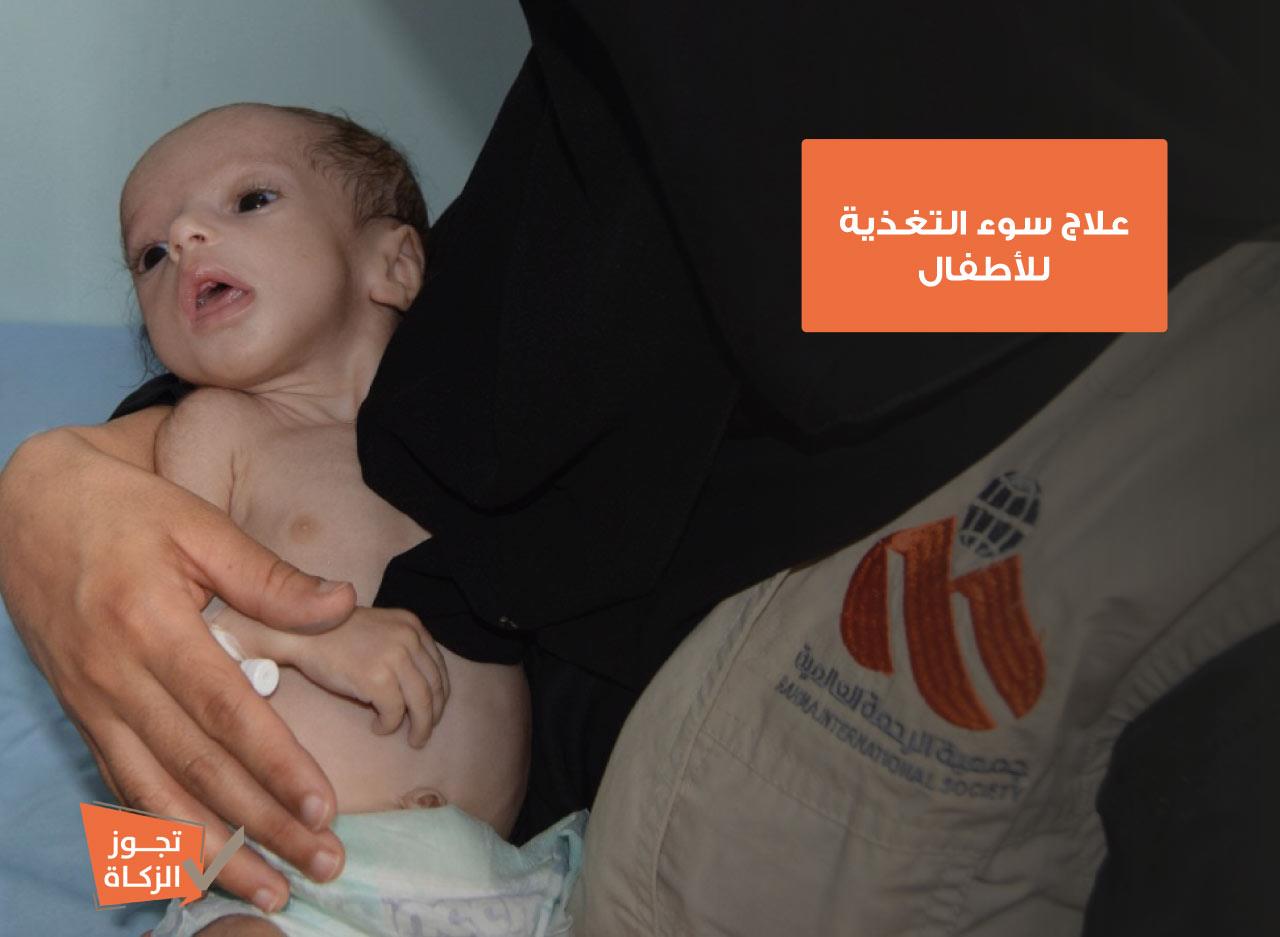 أطفال اليمن - نستهدف علاج 10000 طفل